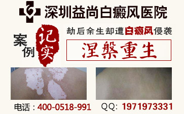 ˰粻ƻô